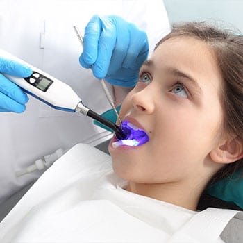 Sealants at North Shore Smiles